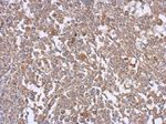 EFHD2 Antibody in Immunohistochemistry (IHC)