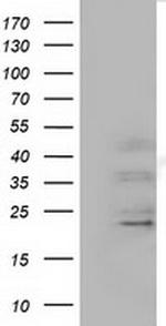 EFNA2 Antibody in Western Blot (WB)