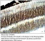 EFEMP1 Polyclonal Antibody