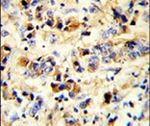 EGFR Antibody in Immunohistochemistry (IHC)