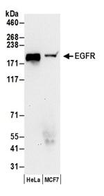 EGFR Antibody in Western Blot (WB)