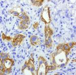 EGFR Antibody in Immunohistochemistry (Paraffin) (IHC (P))