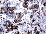 EGFR Antibody in Immunohistochemistry (Paraffin) (IHC (P))