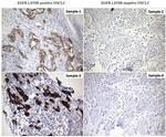EGFR L858R Antibody in Immunohistochemistry (Paraffin) (IHC (P))