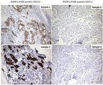 EGFR L858R Antibody in Immunohistochemistry (Paraffin) (IHC (P))