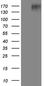EGFR L858R Antibody in Western Blot (WB)