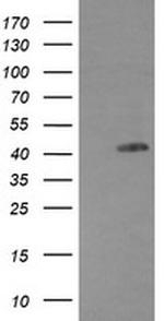 EGFR Antibody in Western Blot (WB)