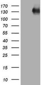 EGFR Antibody in Western Blot (WB)