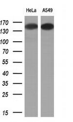 EGFR Antibody in Western Blot (WB)