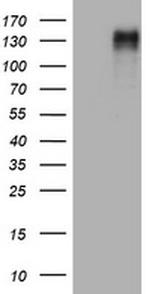 EGFR Antibody in Western Blot (WB)
