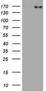 EGFR Antibody in Western Blot (WB)