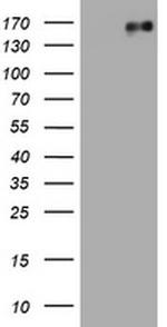EGFR Antibody in Western Blot (WB)