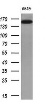 EGFR Antibody in Western Blot (WB)