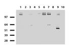 EGFR Antibody in Western Blot (WB)