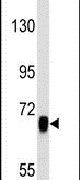 EGFR Antibody in Western Blot (WB)