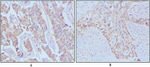 EGF Monoclonal Antibody (9D7F11)