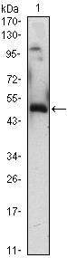 EGR1 Monoclonal Antibody (8A6)
