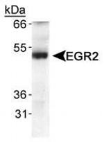 EGR2 Antibody in Western Blot (WB)