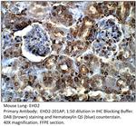 EHD2 Polyclonal Antibody