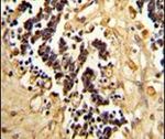 EHD3 Antibody in Immunohistochemistry (IHC)