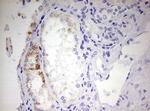 EHHADH Antibody in Immunohistochemistry (Paraffin) (IHC (P))