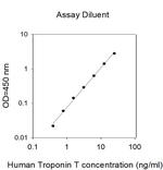Human Troponin T (TNNT1) ELISA Kit