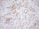 EIF3D Antibody in Immunohistochemistry (Paraffin) (IHC (P))