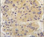 eIF4A1 Antibody in Immunohistochemistry (IHC)