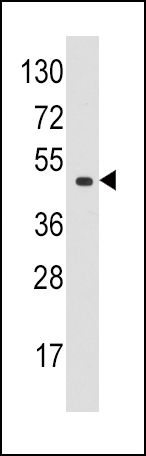 eIF4A1 Antibody in Western Blot (WB)