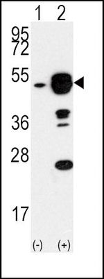 eIF4A1 Antibody in Western Blot (WB)