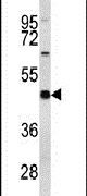 eIF4A2 Antibody in Western Blot (WB)
