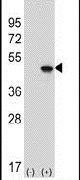 eIF4A2 Antibody in Western Blot (WB)