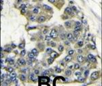 eIF4B Antibody in Immunohistochemistry (IHC)
