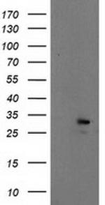EIF4E Antibody in Western Blot (WB)