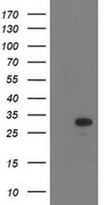 EIF4E Antibody in Western Blot (WB)