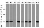 EIF4E Antibody in Western Blot (WB)