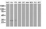 EIF4E2 Antibody in Western Blot (WB)
