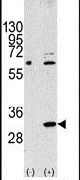 eIF4E2 Antibody in Western Blot (WB)