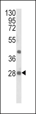 eIF4E2 Antibody in Western Blot (WB)