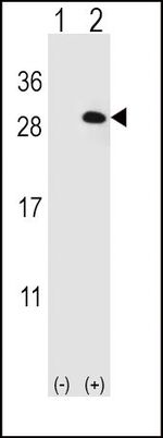 eIF4E2 Antibody in Western Blot (WB)