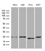 EIF4E3 Antibody in Western Blot (WB)