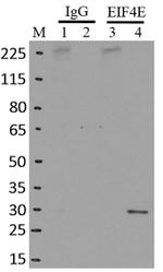 eIF4E Antibody in RNA Immunoprecipitation (RIP)