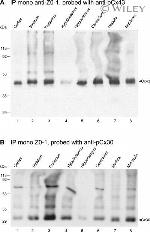 Connexin 30 Antibody in Western Blot (WB)