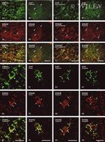 Connexin 47 Antibody in Immunohistochemistry (IHC)