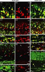 PAX2 Antibody in Immunohistochemistry (IHC)
