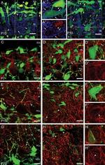 PAX2 Antibody in Immunohistochemistry (IHC)