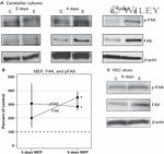 Phospho-FAK (Tyr397) Antibody in Western Blot (WB)