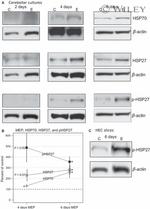 Phospho-HSP27 (Ser85) Antibody in Western Blot (WB)