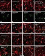 Connexin 30 Antibody in Immunohistochemistry (IHC)