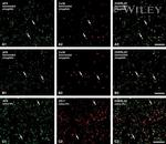 Connexin 36 Antibody in Immunohistochemistry (IHC)